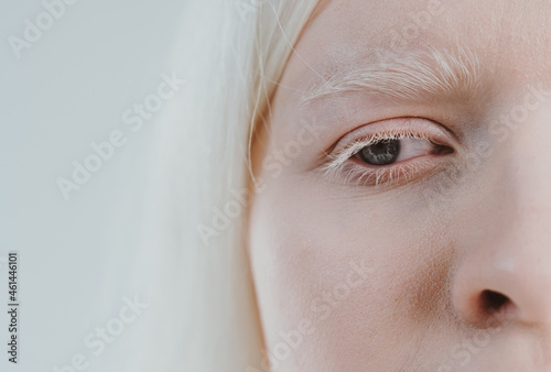 Принти на полотні Beauty image of an albino girl posing in studio wearing lingerie