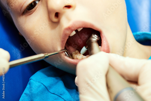 pediatric dentist checks teeth of a little one