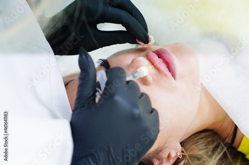 Foto Injections of the lips