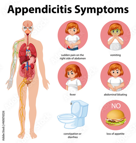 Appendicitis Symptoms information infographic