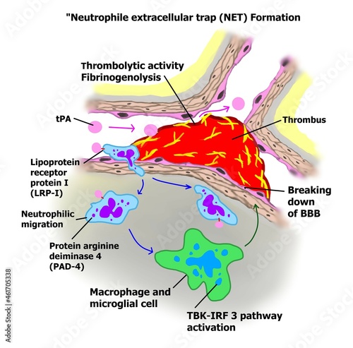 NET is the process of neuronal inflammation in stroke, AD and multiple sclerosis. photo