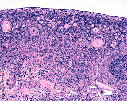 Ovarian cortex. Follicles photo