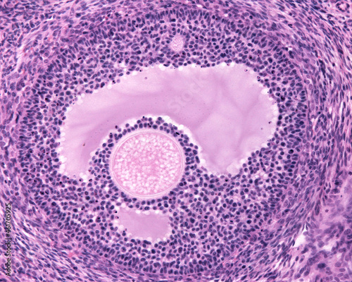 Ovary. Early tertiary follicle photo