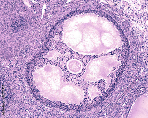 Ovary. Antral or tertiary follicle photo