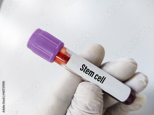 Obraz na płótnie Blood sample tube for stem cells test, neurological or heart disease, embryonic