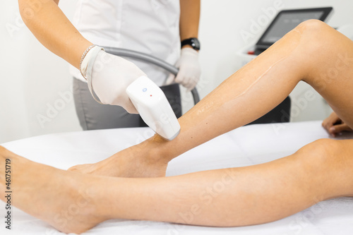 Doctor removes hairs from the skin of the patient's legs with a laser