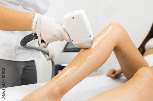 Laser hair removal process for woman's legs photo