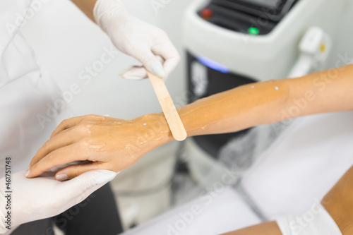 Laser hair removal specialist applies a cooling gel to a client s hand