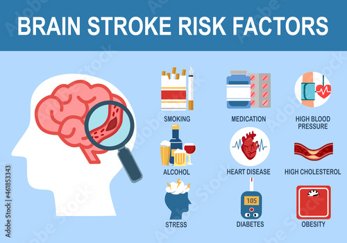 Brain stroke risk factors infographic in flat design. 