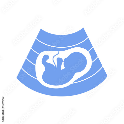 blue icon ultrasound of fetus