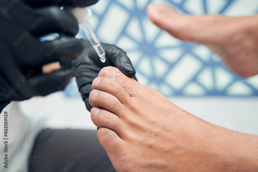 Pedicure specialist pouring serum on man toenail