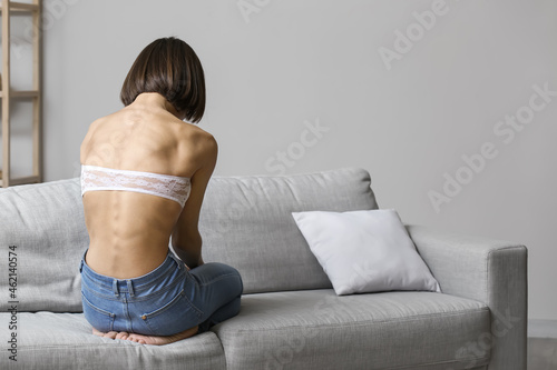 Young woman with anorexia a...