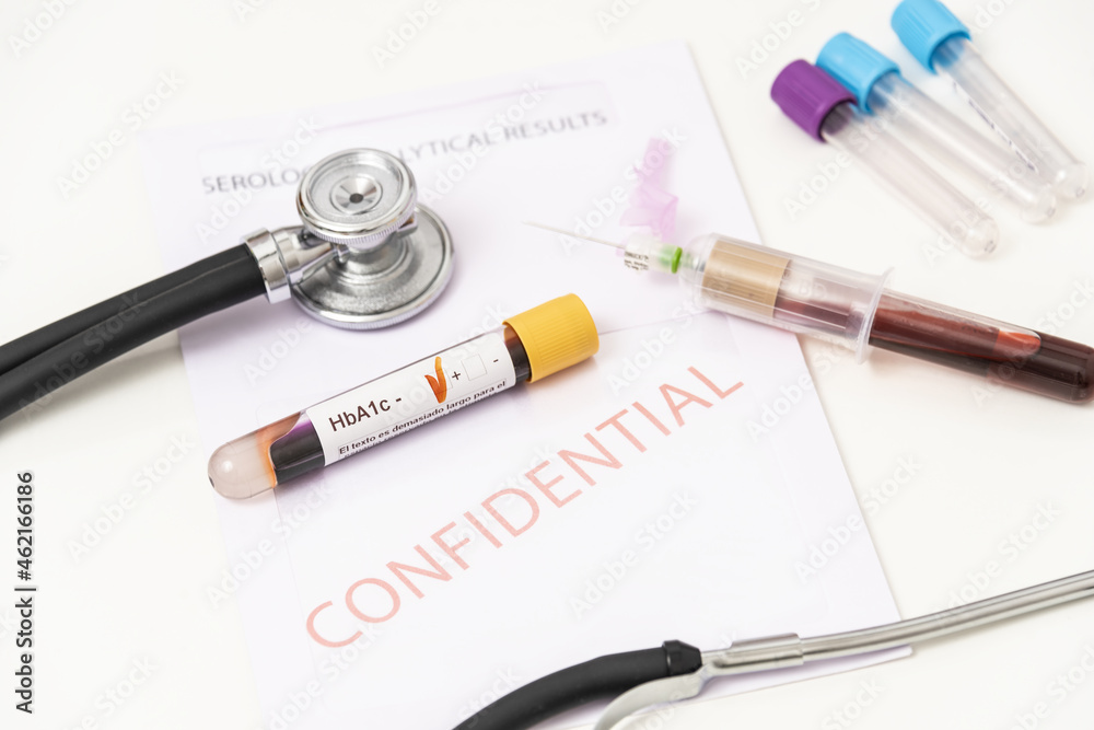 Close-up of positive blood sample from hBA1c diabetes.