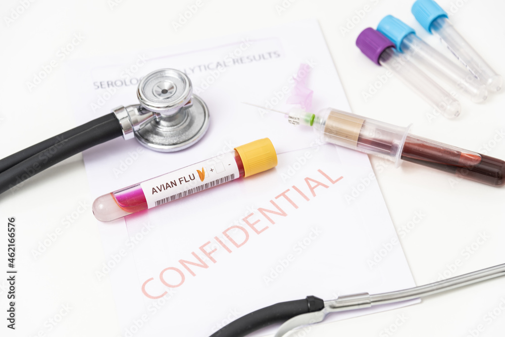 H10N3 bird flu test, blood sample tube for influenza A virus subtype H10N3 test. H10N3 bird flu test, blood sample tube for influenza A virus subtype H10N3 test.