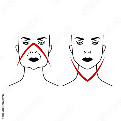 Lifting of female face. Comparison before and after