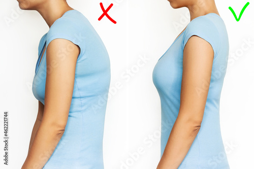 A young woman stands bent and straightened isolated on a white background. Correct and incorrect spine position. Slouching back and healthy spine. A posture before and after changing. Scoliosis photo