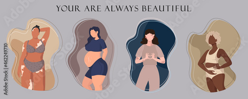 Collection of body positive diverse women. Set of girls with black skin or vitiligo in lingerie and pregnant. Your are beautiful