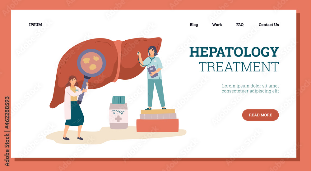 Female doctor and nurse examine liver with hepatitis disease, landing page template - flat vector illustration. Female doctor and nurse examine liver with hepatitis disease, landing page template - flat vector illustration.
