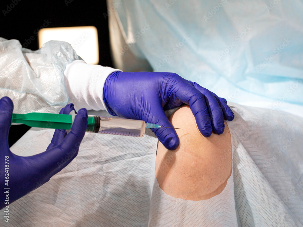The doctor makes a therapeutic intraarticular injection into the knee