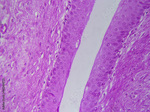 Microscope histology image of transitional epithelial of urinary bladder (400x) photo