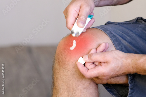 A man smears a sore knee with ointment for the joints.