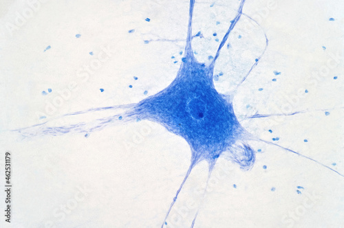 Konstfotografi Neurons cells from the brain under the microscope view.