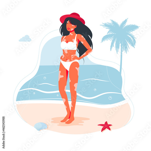 Vitiligo skin disease in a girl in a swimsuit and a hat. A woman diagnosed with vitiligo does not hesitate to sunbathe on the beach. the concept of different beauty, bodily positive, self-acceptance. photo