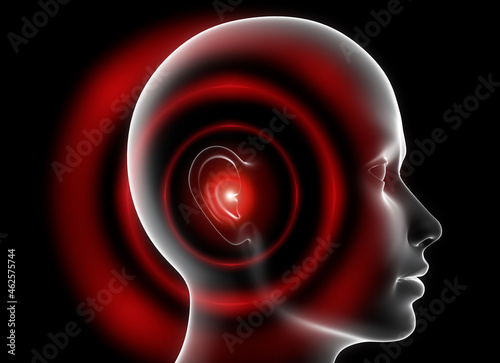 Fotografía Gray head with ear pain or tinnitus - 3D illustration