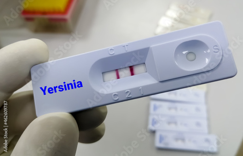 Rapid device for Yersinia pestis. plague disease