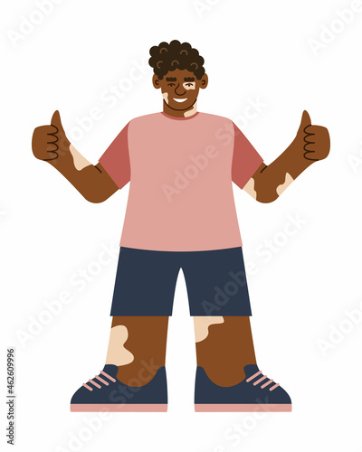 Smiling young African man, teenager with vitiligo. A happy, confident black schoolboy with white pigmentation. Vector illustration in flat style.