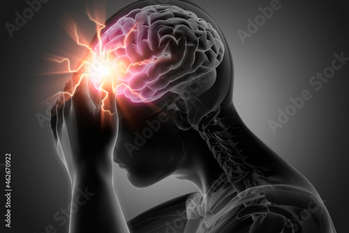 Strong headache pain - conceptual artwork-3d illustration	
 photo