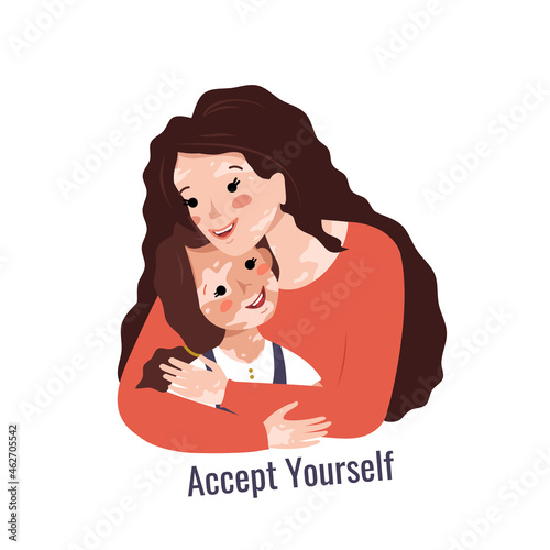 Beautiful mother with long hair and vitiligo hugs her daughter. Inscription accept yourself. Vector illustration of skin diseases and taking care of your body. Teach your child to love himself