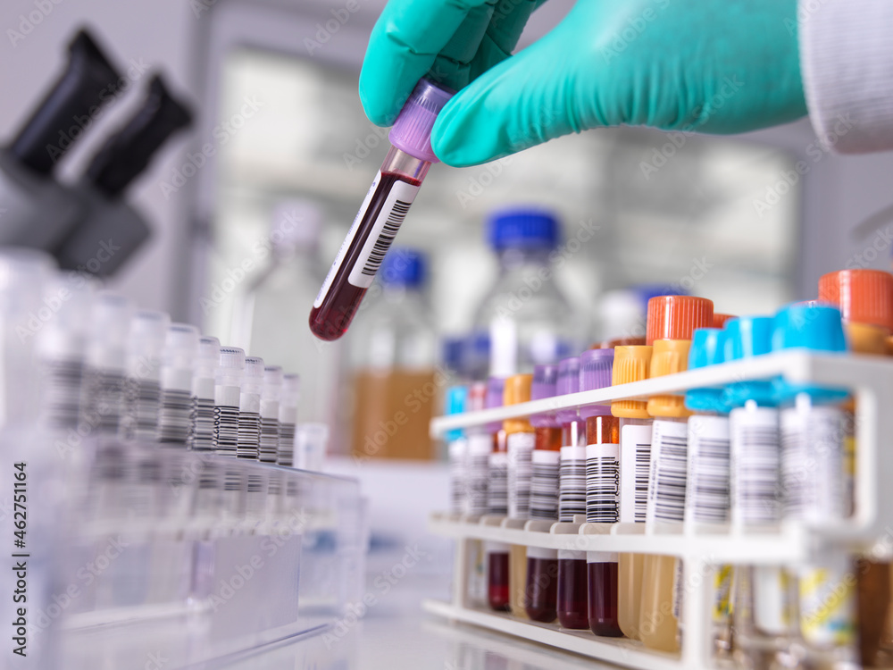 Hand of scientist wearing protective glove picking up sample in laboratory Hand of scientist wearing protective glove picking up sample in laboratory