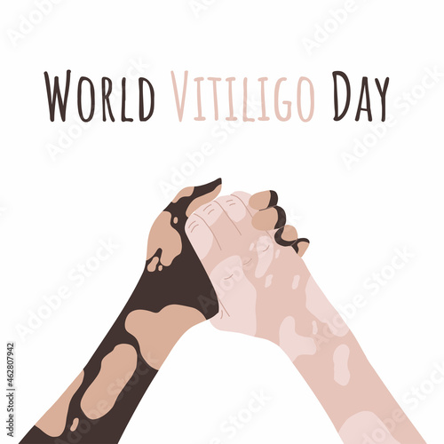 Hands with vitiligo disease. Support for people with skin pigmentation disorders. Different skin colors, different nationalities. Hand drawn illustration. Vector image on a white background