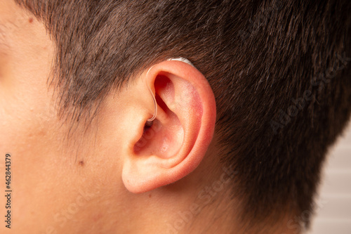 People with wireless hearing aids in the ear