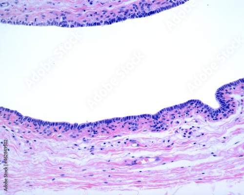 Human breast gland. Lactiferous duct photo