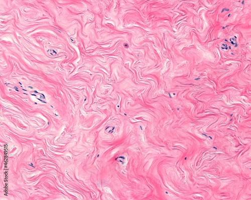 Human mammary gland. Breast stroma photo