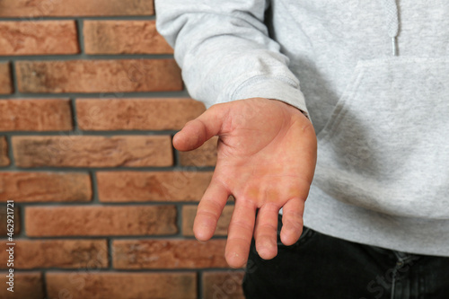 Man suffering from calluses on hand near brick wall, closeup
