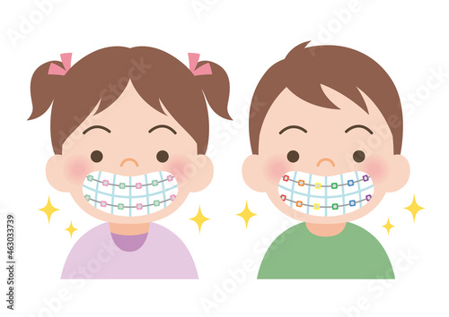 カラフルな装置で歯並びの矯正をする子供