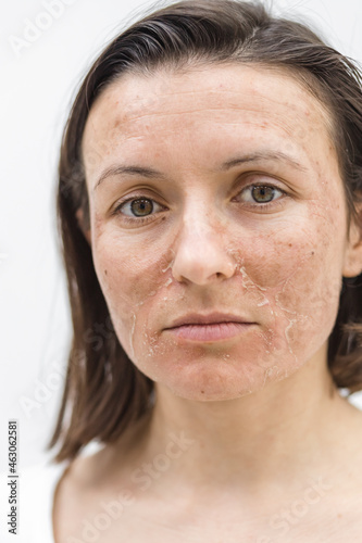 Cropped photo of woman with dry skin over white background.