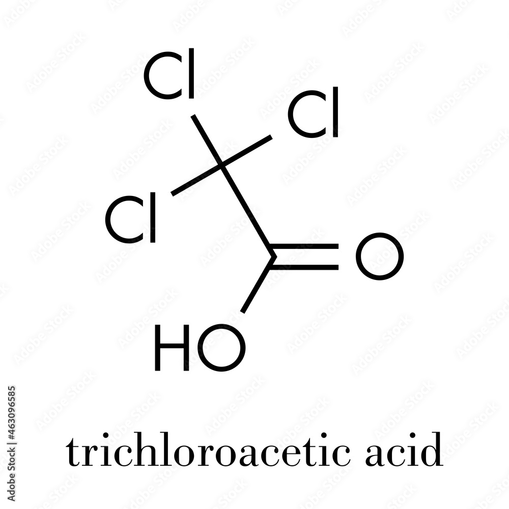Trichloroacetic acid (TCA) molecule. Used in dermatological treatment