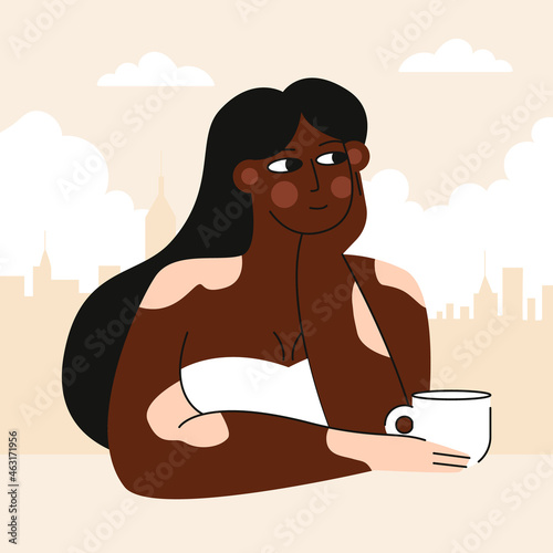 Flat vector illustration. Portrait of an Afro American woman with vitiligo skin disease.