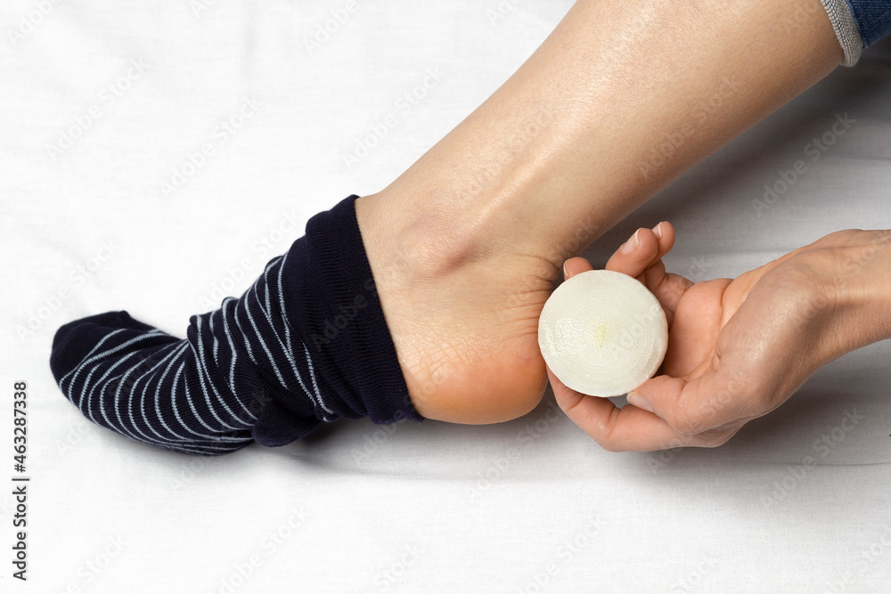 Onions on the feet in socks for the common cold. Onions on the feet in socks for the common cold.