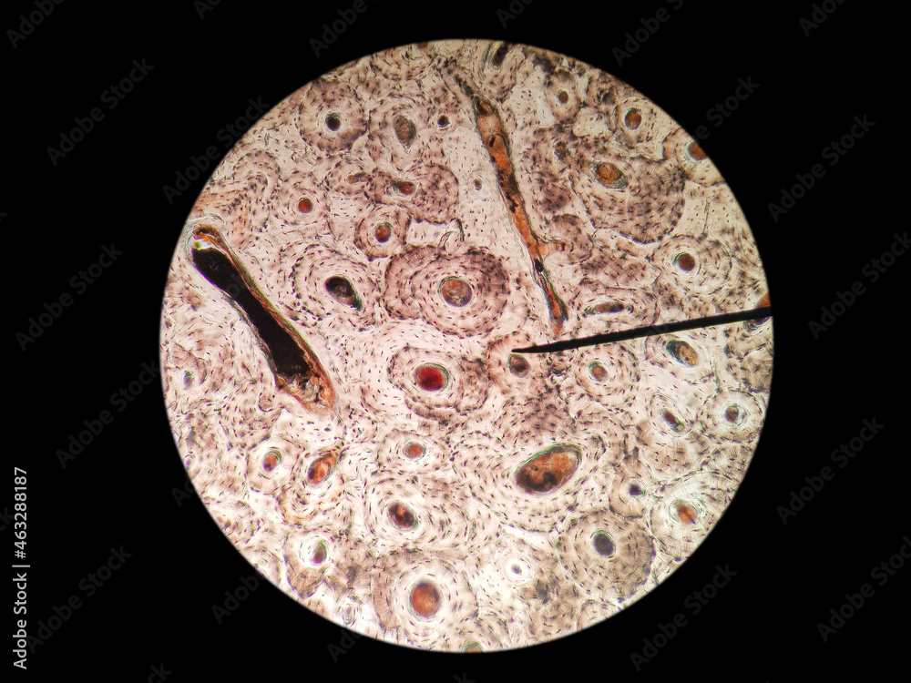 Histological of compact ground bone (haversian system/osteon) cross section