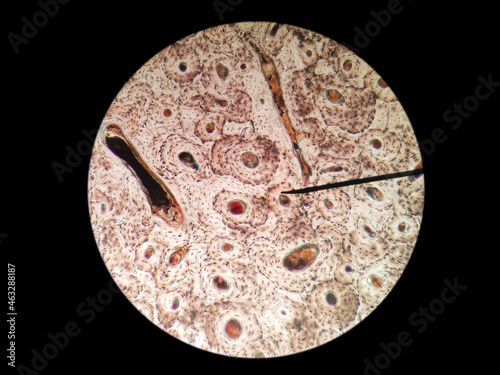 Histological of compact ground bone (haversian system/osteon) cross section photo
