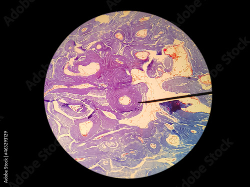 Histology of decalcified bone cross section photo