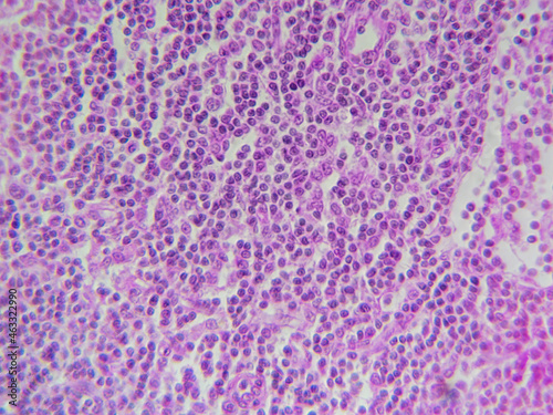 Histology microscope image of loose reticular tissue of lymph node (400x) photo