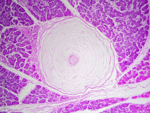 Histology microscope image of Pacinian corpuscle of the dermis in skin (100x) photo