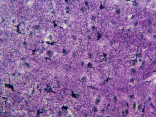 Histology microscope image of astrocytes in the brain (400x) photo
