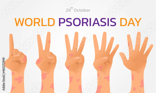 Fototapeta Naklejka Na Ścianę i Meble -  World Psoriasis Day concept. October 29. Psoriasis Awareness Month Vector Illustration.